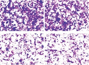 Figure from article: Cyclin-dependent kinase...