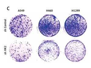 Figure from article: High expression of...