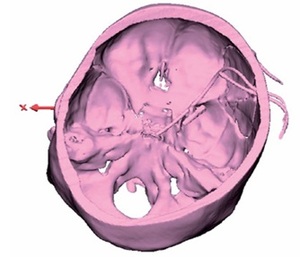 Figure from article: A clinical study on the...