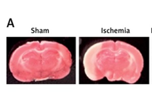 Figure from article: Upregulation of Foxo3a...