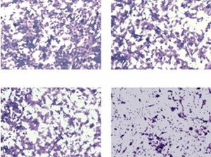Figure from article: miR-338-3p attenuates...