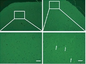 Figure from article: P2X7 blockade inhibits the...