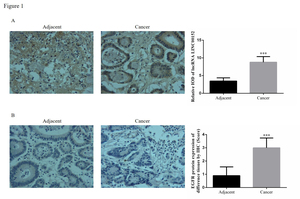 Figure from article: lncRNA LINC00152 knockdown...