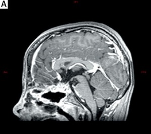 Figure from article: Case report of two growth...