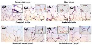 Adipokine signatures of subcutaneous and visceral abdominal fat in  normal-weight and obese women with different metabolic profiles